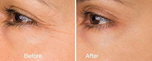 DNA Code-No Needle Alternative-Argireline NeuroPeptides Wrinkle Reduce Cream w/Matrixyl 3000, Syn-Ake, SNAP-8, Copper…
