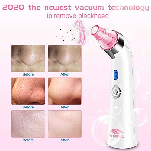 Blackhead Remover Pore Vacuum Electric Blackhead Vacuum Cleaner Blackhead Extractor Tool Device Comedo Removal Suction…