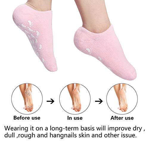 Moisturizing Socks Heel Gel Sock – Callus Rough Foot Care Treatment Soft Silicone Gel Lined Infused Lotion Spa Socks|2…