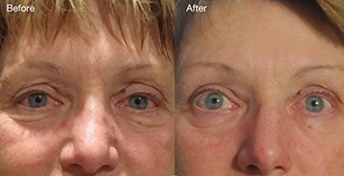 Magic Serum-Swiss Apple Stem Cell Complex Serum w/Argireline, Matrixyl 3000, Hyaluronic Acid, CoQ10. 8 OZ