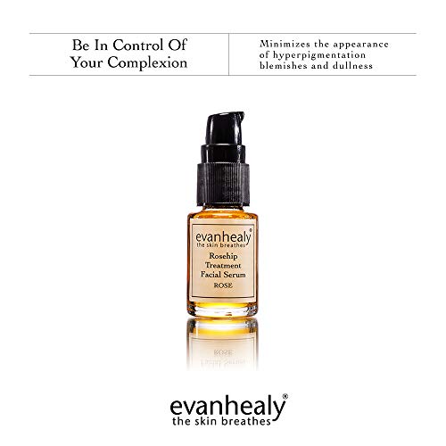 evanhealy Rosehip Facial Serum – Moisturizing & Plumping – All-Natural Hydrosols & Essential Oils – Damaged & Sensitive…