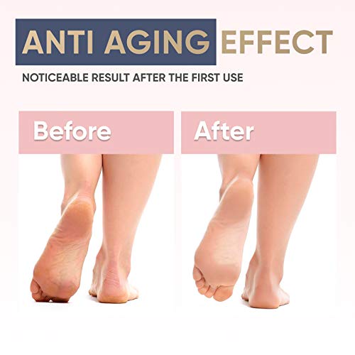 Moisturizing Foot Mask for Dry Cracked Feet & Heels – Korean Foot Care Mask Spa – Ultra Hydrating Socks with Shea butter…