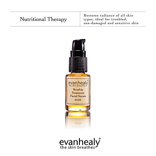 evanhealy Rosehip Facial Serum – Moisturizing & Plumping – All-Natural Hydrosols & Essential Oils – Damaged & Sensitive…