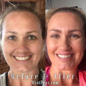 Collagen Peptides Face Serum 30 ml – Anti Aging Skin Care Facial Serum – Collagen Booster Tri Peptide Firming Serum…