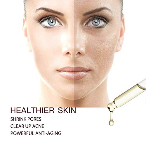 Youngfocus vitamin c skin serum facial serum hyaluronic acid organic anti aging face serum with vitamin e boost collagen…