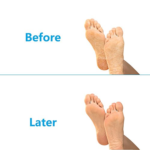Pinkiou Moisturizing Gloves Socks Set Gel Spa for Moisturize Soften Repairing Dry Hands Feet Cracked Skin Care Silicone…