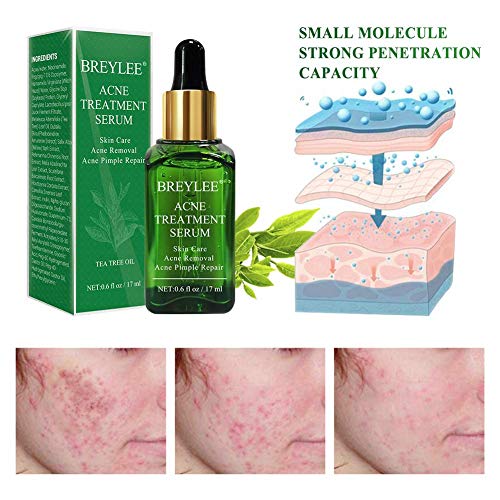 Acne Treatment Serum plus Acne Facial Cleanser, BREYLEE Acne Treatment Set Pimple Clear Skin Kit for Clearing Severe…
