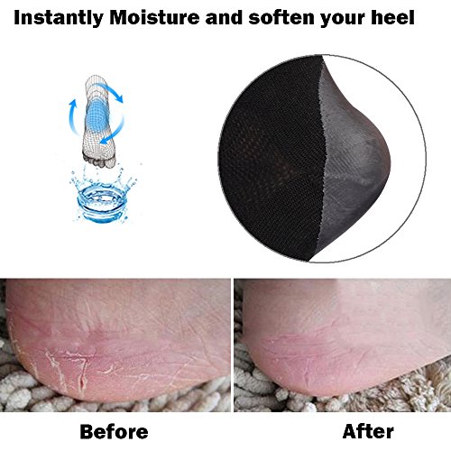 Codream 2 Pairs Heels Moisturizing Socks for Dry Cracked Heels Repair Treatment Vented Moisturizing Gel Heel Sleeves…