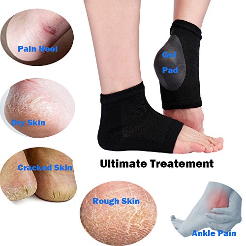 Codream 2 Pairs Heels Moisturizing Socks for Dry Cracked Heels Repair Treatment Vented Moisturizing Gel Heel Sleeves…