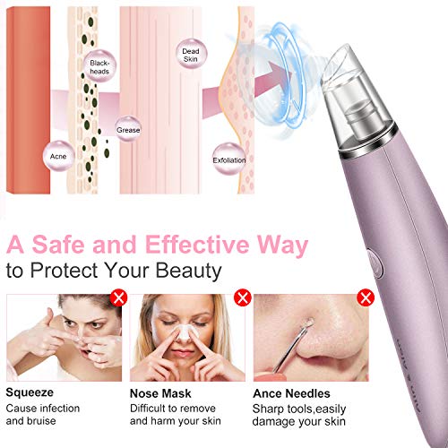 Blackhead Remover Vacuum Pore Cleaner, Alin&Alan Electric Blackhead Vacuum Suction Devices, USB Rechargeable Acne…