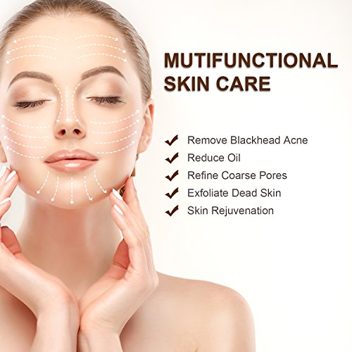 HOPOSO Blackhead Remover Pore Vacuum Facial Nose Pore Cleaner Pimple Acne Comedone Extractor Electric Blackhead Removal…