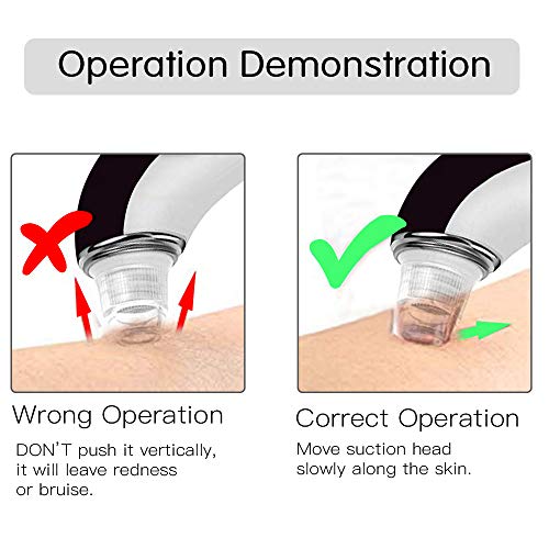 QQcute Blackhead Remover, Electric Vacuum Suction Pore Cleaner, Acne Comedone Pimple Whitehead Makeup residue Extractor…
