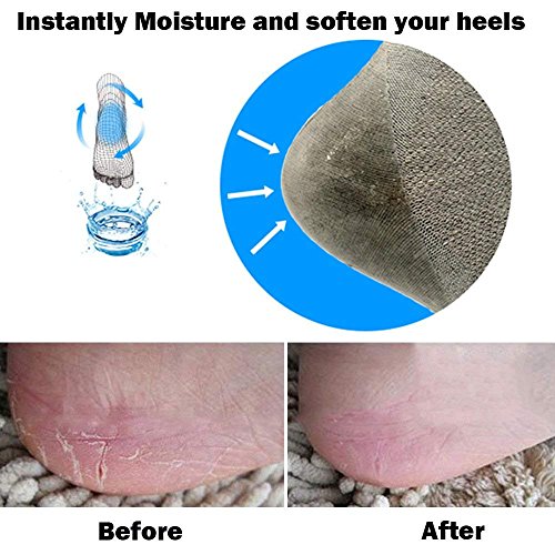 Codream Vented Moisturizing Socks Lotion Gel for Dry Cracked Heels, Spa Gel Socks Humectant Moisturizer Heel Balm Foot…