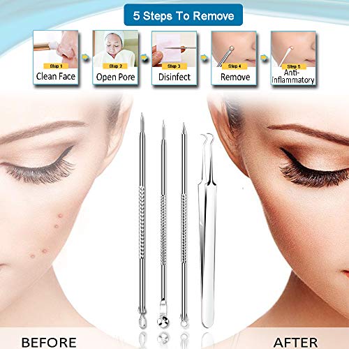 [Upgraded] 8PCS Blackhead Remover, Pimple Tool Kit, Acne Tools, Comedone Extractor, Blemish Whitehead Removal…