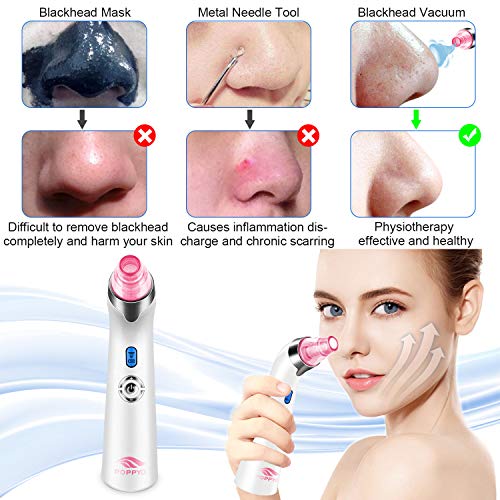 Blackhead Remover Pore Vacuum Electric Blackhead Vacuum Cleaner Blackhead Extractor Tool Device Comedo Removal Suction…
