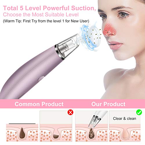 Blackhead Remover Vacuum Pore Cleaner, Alin&Alan Electric Blackhead Vacuum Suction Devices, USB Rechargeable Acne…