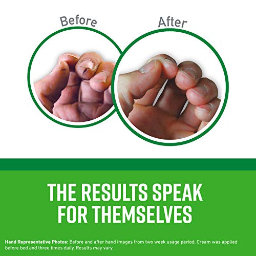 O’Keeffe’s Working Hands Hand Cream, 3 oz Tube and Night Treatment Hand Cream, 3 oz Tube