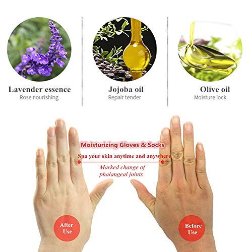 Codream Moisturizing Gloves, Moisturizing Socks, Gel Gloves and Gel Socks Set with Gel Repair for Cracked Dry Skin…