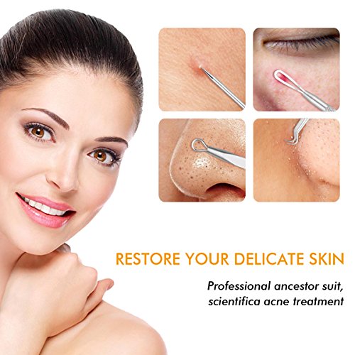 7-Piece Blackhead Remover Kit – Pimple Comedone Extractor Tool set for Facial Acne and Treatment for Blemish, Whitehead…