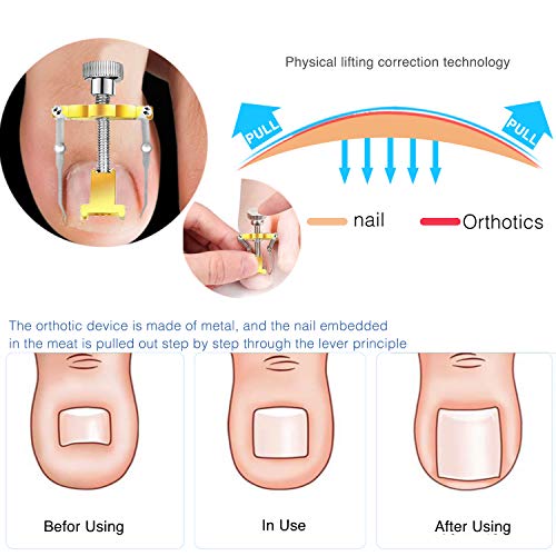 Professional Pedicure Tools Kit 20 in 1,Foot Care Kit Stainless Steel Foot Rasp Foot Peel and Callus Clean Foot Dead…