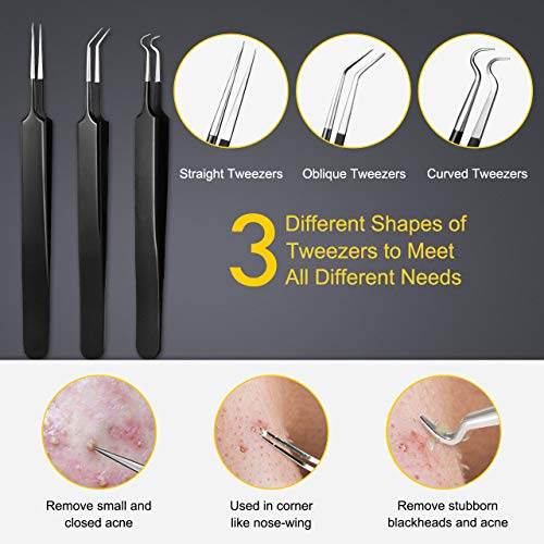 Pimple Popper Tool Kit – Boxoyx 10 Pcs Blackhead Remover Comedone Extractor Kit with Metal Case for Quick and Easy…