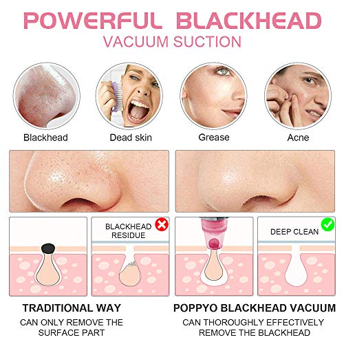 Blackhead Remover Pore Vacuum Electric Blackhead Vacuum Cleaner Blackhead Extractor Tool Device Comedo Removal Suction…