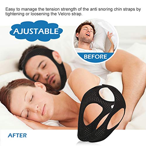 Anti Snoring Chin Strap, Snore Chin Strap, Stop Snoring Chin Strap, Anti Snoring Devices (1 Count (Pack of 1))