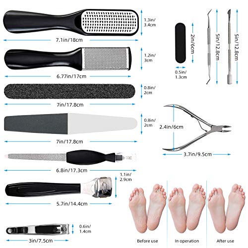 Pedicure Kit 15 in 1, Glynee Pedicure Set Foot File Callus Remover Hard,Cracked, Dead Skin Foot Skin Care Tool…