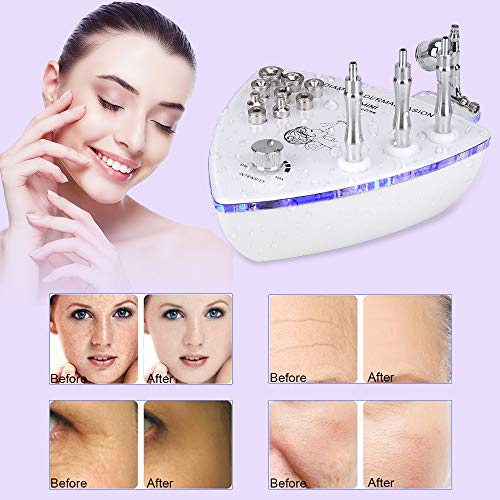 MYSWEETY Professional Diamond Microdermabrasion Dermabrasion Machine (65-70cmHg Suction Power) Facial Care Skin…