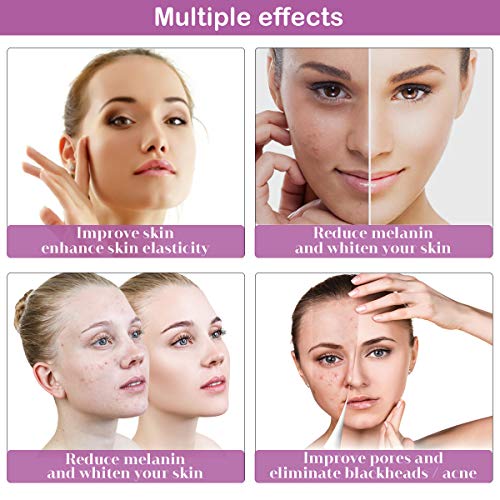 Diamond Microdermabrasion Machine, Yofuly 65-68cmHg Suction Power Professional Dermabrasion, Home Use Facial Skin Care…