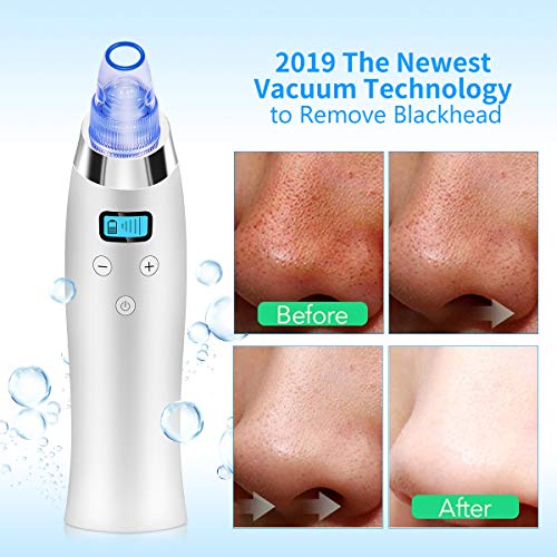 Comezy Blackhead Remover Pore Vacuum with 4 Probes，Electric Blackhead Removal Suction Extractor Kit Tools，5 Adjustable…