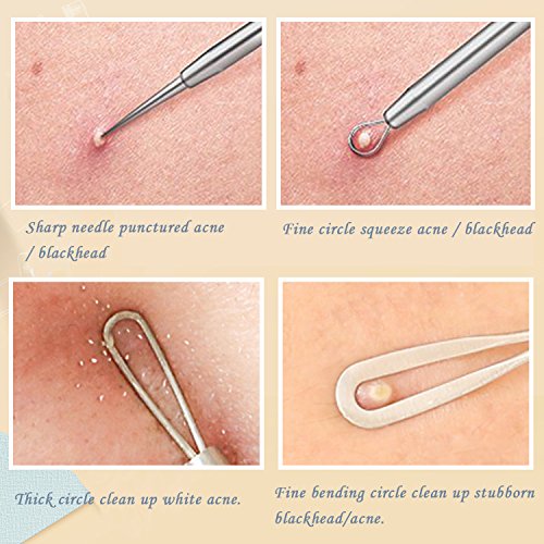 Blackhead Remover Pimple Popper Tool Kit, 6-in-1 Blackhead Comedone Acne Blemish Pimple Extractor Tool Kit Tweezers Kit…