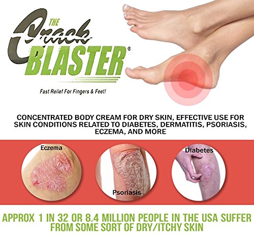 Crack Blaster Repair Balm, Multi-Purpose Dry Skin Balm, Intense Repair Treatment For Cracked Heels, Dry Cracked Hands…