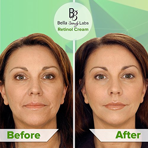 Retinol Moisturizer Anti Aging Cream for Face and Eye Area – With Hyaluronic Acid – 2.5% Active Retinol – Vitamin E…