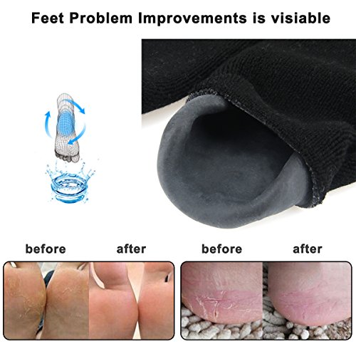 Codream Large Men’s Moisturizing Gel Socks Men’s Feet Care Ultimate Treatment for Dry Cracked Rough Skin on Feet Pack of…