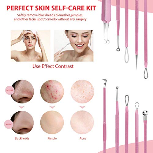 10PCS Blackhead Remover Tool, Aooeou Professional Pimple Popper Tool Kit – Treatment for Blemish, Whitehead Popping, Zit…
