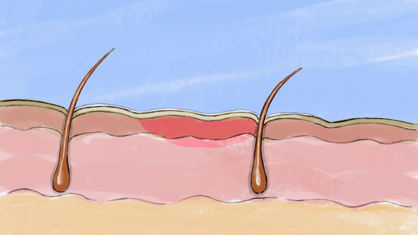 Adamia Therapeutic Repair Lotion with Macadamia Nut Oil and Promega-7, 16 Fl Oz Bottle- Fragrance Free, Paraben Free…