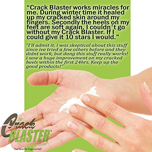 Crack Blaster Repair Balm, Multi-Purpose Dry Skin Balm, Intense Repair Treatment For Cracked Heels, Dry Cracked Hands…