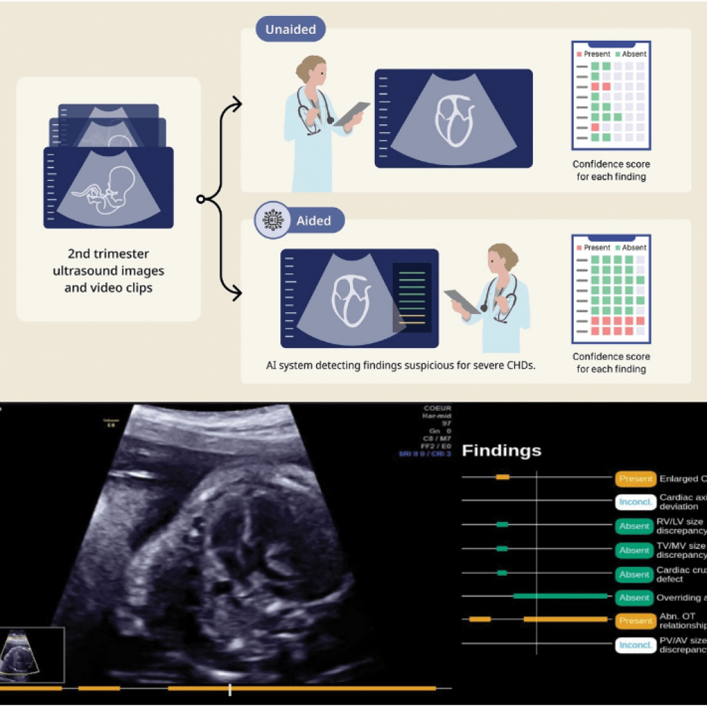 Mount Sinai Deploys AI-Enhanced Fetal Ultrasounds Mount Sinai Deploys AI-Enhanced Fetal Ultrasounds