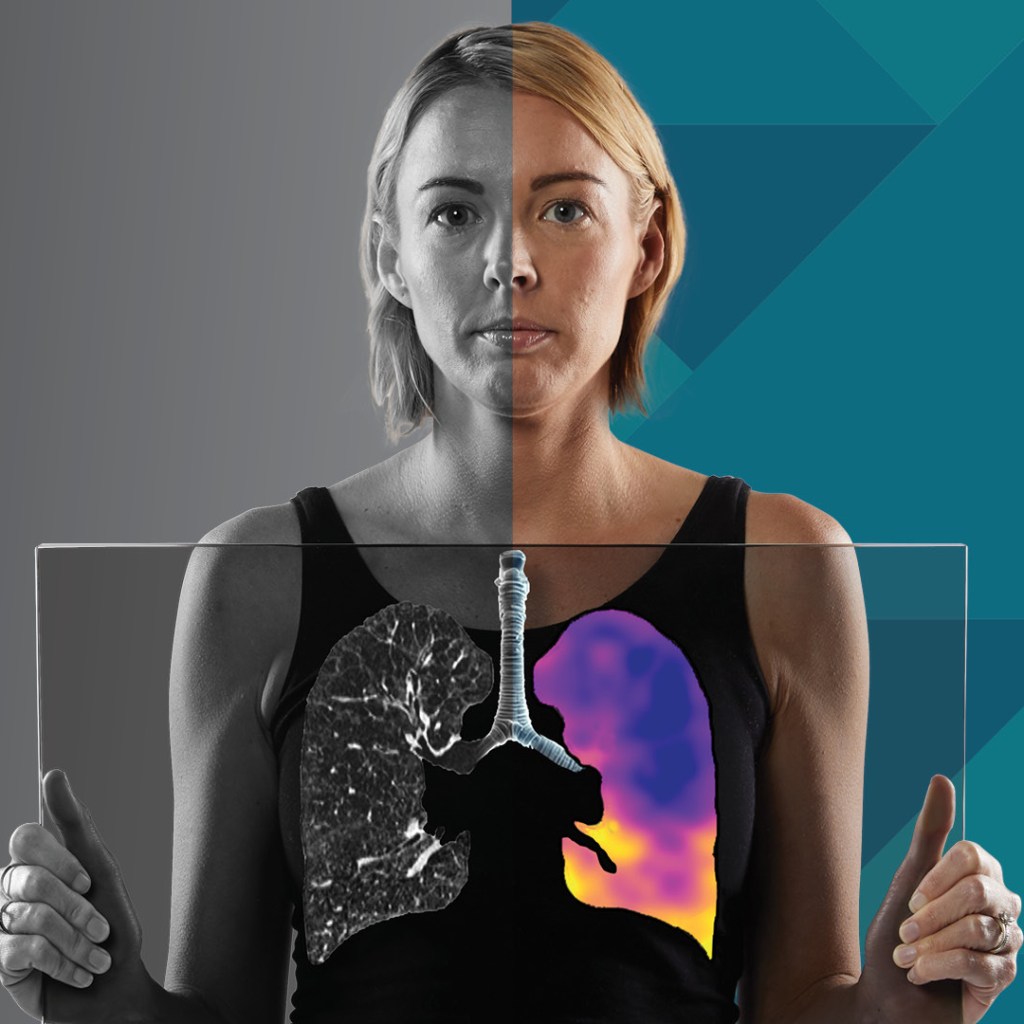 4DMedical Secures 0M+ to Scale U.S. Respiratory Imaging Rollout – 4DMedical Secures 0M+ to Scale U.S. Respiratory Imaging Rollout –