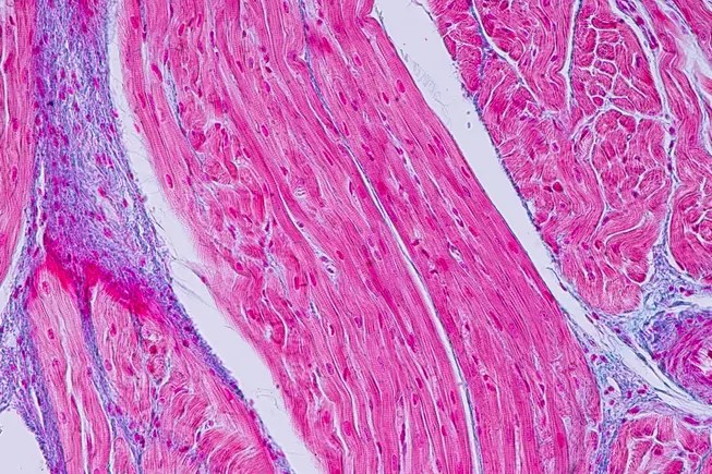 Medtronic leads M investment in ablation mapping startup CoreMap Medtronic leads M investment in ablation mapping startup CoreMap