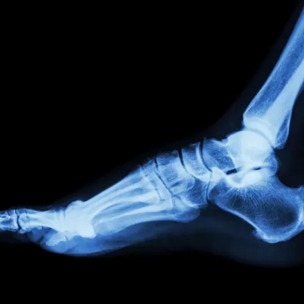Zimmer launches 2 devices from .1B orthopedic takeover Zimmer launches 2 devices from .1B orthopedic takeover