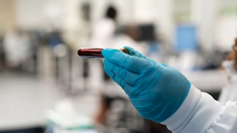 Grail multicancer detection test wins FDA advisers’ backing Grail multicancer detection test wins FDA advisers’ backing