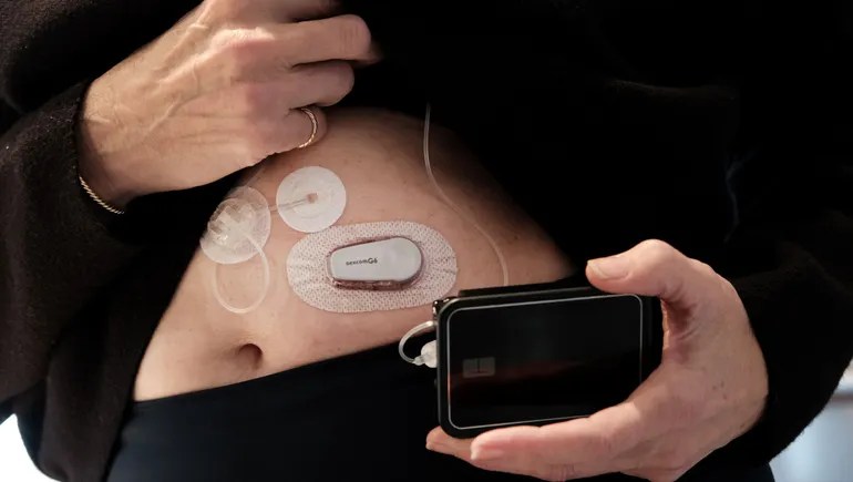 Diabetes tech companies are racing toward ‘fully closed loop’ devices. But automation comes with trade-offs. Diabetes tech companies are racing toward ‘fully closed loop’ devices. But automation comes with trade-offs.