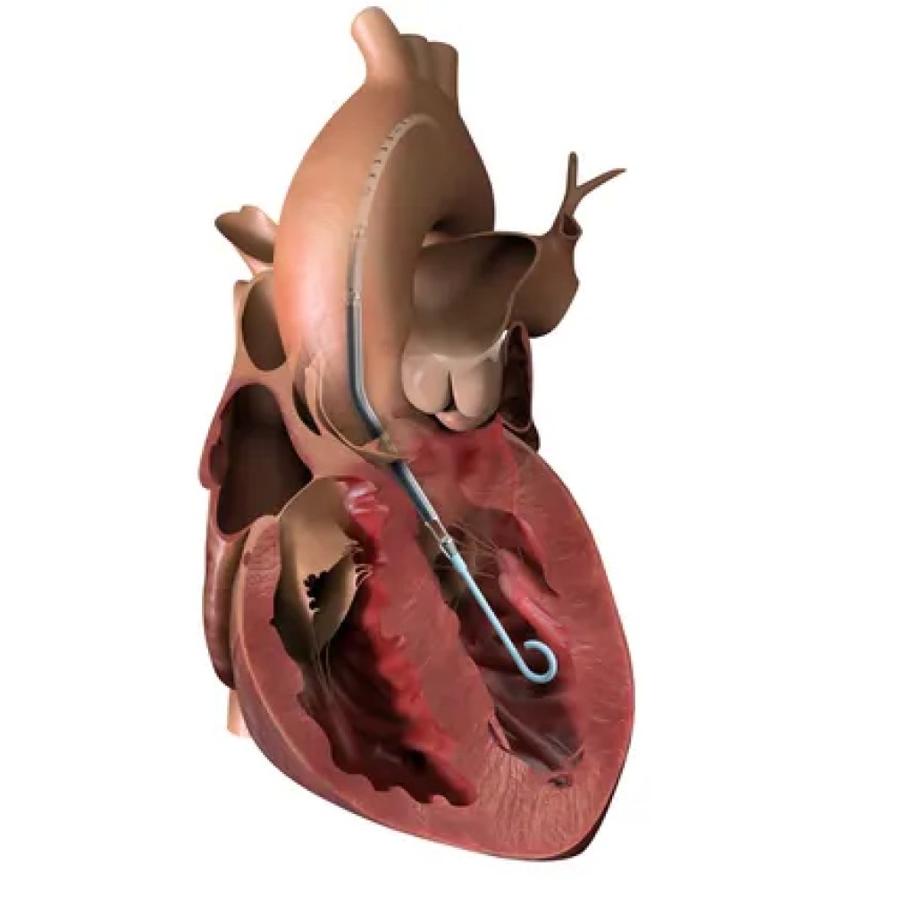 J&J’s Abiomed starts third heart pump controller recall since June J&J’s Abiomed starts third heart pump controller recall since June