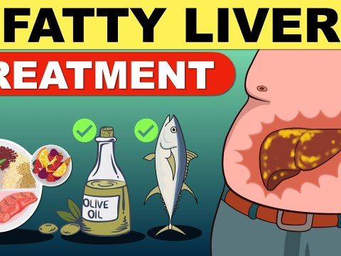 Fatty Liver Treatment | Fatty Liver Diet | Liver Detox | Fatty Liver | Fatty Liver Symptoms Fatty Liver Treatment | Fatty Liver Diet | Liver Detox | Fatty Liver | Fatty Liver Symptoms
