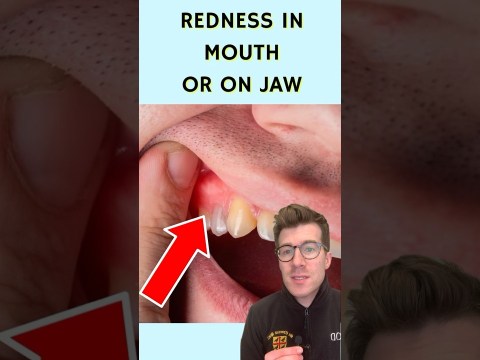 7 signs of a dental abscess … #shorts 7 signs of a dental abscess … #shorts