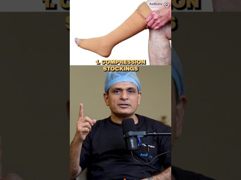 5 best ways to treat varicose veins. 5 best ways to treat varicose veins.