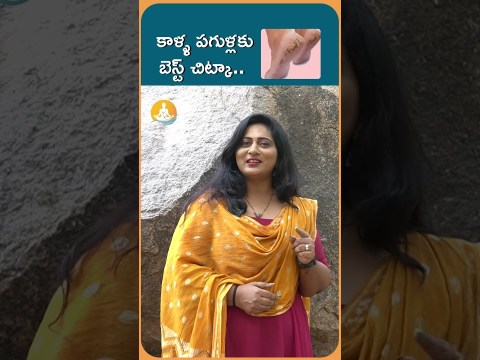 కాళ్ళ పగుళ్లకు బెస్ట్ చిట్కా | #CrackedHeels Home Remedy | #DrCalmsSanjeevani కాళ్ళ పగుళ్లకు బెస్ట్ చిట్కా | #CrackedHeels Home Remedy | #DrCalmsSanjeevani