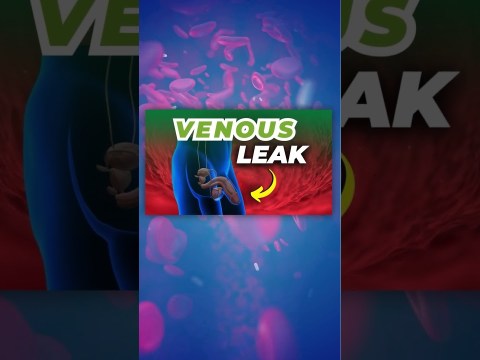 Venous Leak and ED: What You Need to Know Venous Leak and ED: What You Need to Know